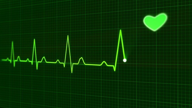Treperenje srca  (ventrikularna fibrilacija) – nakon isporuke elektro šoka uspostavlja se normalan srčani rad ❗❗❗